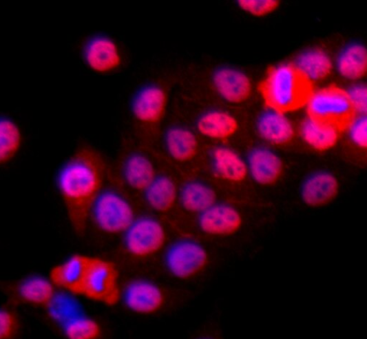 小鼠胰腺导管上皮细胞