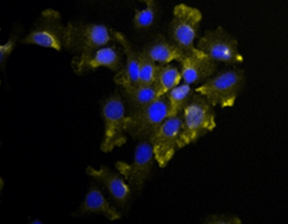 大鼠前列腺平滑肌细胞