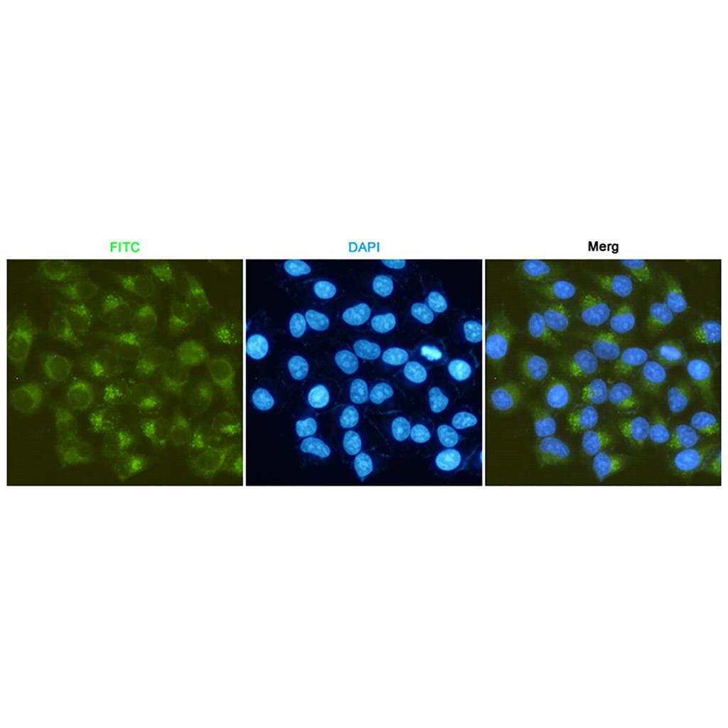 MMP2 (3A8) Mouse Monoclonal Antibody | 鼠单抗 | EnkiLife恩玑生命