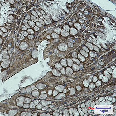 NDUFB11 Rabbit Monoclonal Antibody | 兔单抗 | EnkiLife恩玑生命