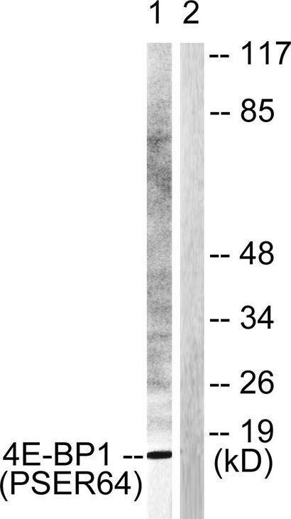4E-BP1 (phospho Ser65) Rabbit Polyclonal Antibody | 兔多抗 | EnkiLife恩玑生命