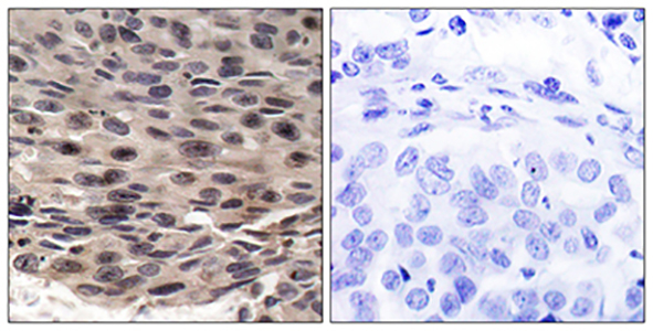 4E-BP1 (phospho Thr37) Rabbit Polyclonal Antibody | 兔多抗 | EnkiLife恩玑生命