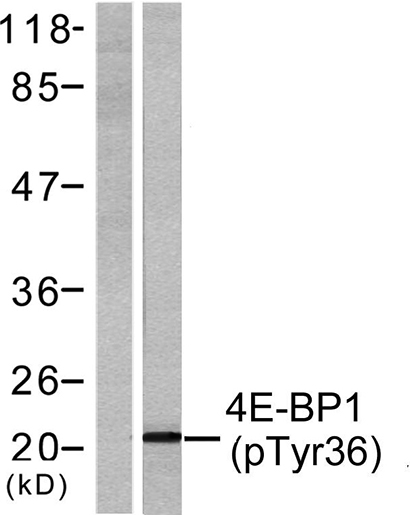 4E-BP1 (phospho Thr37) Rabbit Polyclonal Antibody | 兔多抗 | EnkiLife恩玑生命