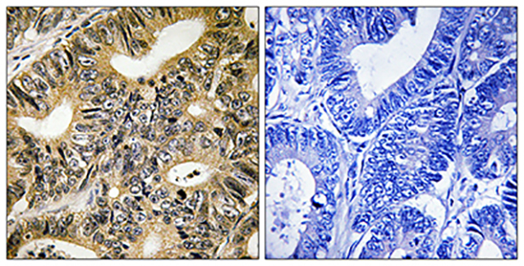 4E-BP1 (phospho Thr70) Rabbit Polyclonal Antibody | 兔多抗 | EnkiLife恩玑生命