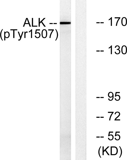 ALK (phospho Tyr1507) Rabbit Polyclonal Antibody | 兔多抗 | EnkiLife恩玑生命