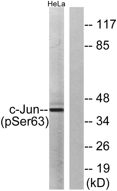 AP-1 (phospho Ser63) Rabbit Polyclonal Antibody | 兔多抗 | EnkiLife恩玑生命