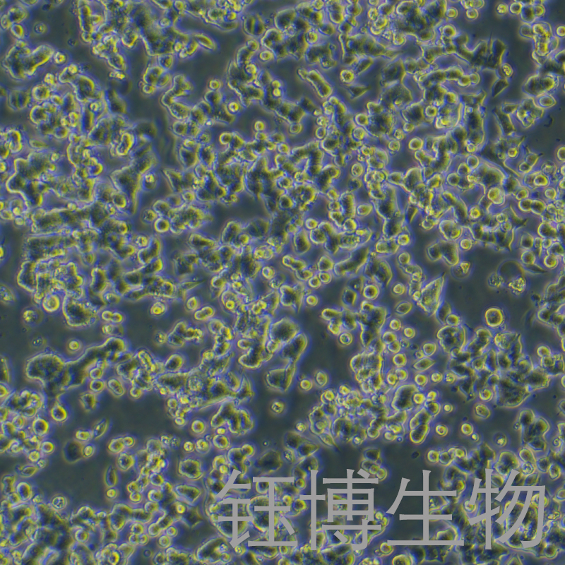 NCI-H810（人非小细胞肺癌细胞）YB-72022HC