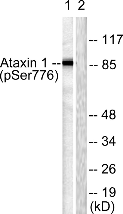 Ataxin-1 (phospho Ser776) Rabbit Polyclonal Antibody | 兔多抗 | EnkiLife恩玑生命