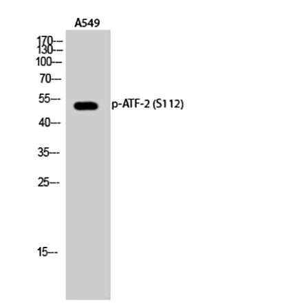 ATF-2 (phospho Ser112) Rabbit Polyclonal Antibody | 兔多抗 | EnkiLife恩玑生命