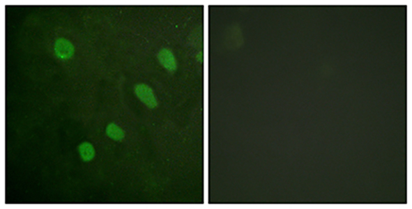 ATF-2 (phospho Ser480) Rabbit Polyclonal Antibody | 兔多抗 | EnkiLife恩玑生命