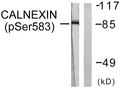 Calnexin (phospho Ser583) Rabbit Polyclonal Antibody | 兔多抗 | EnkiLife恩玑生命