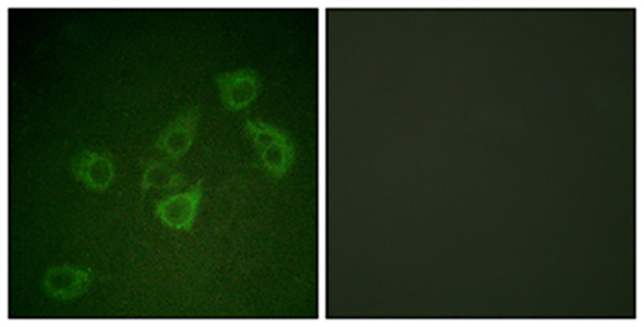 Caspase-6 (phospho Ser257) Rabbit Polyclonal Antibody | 兔多抗 | EnkiLife恩玑生命