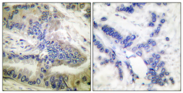 Caspase-6 (phospho Ser257) Rabbit Polyclonal Antibody | 兔多抗 | EnkiLife恩玑生命
