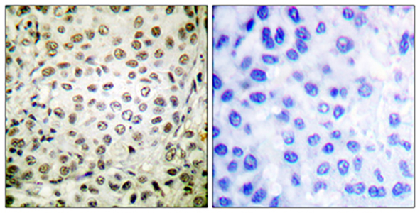 Cdk2/Cdc2 (phospho Thr160) Rabbit Polyclonal Antibody | 兔多抗 | EnkiLife恩玑生命