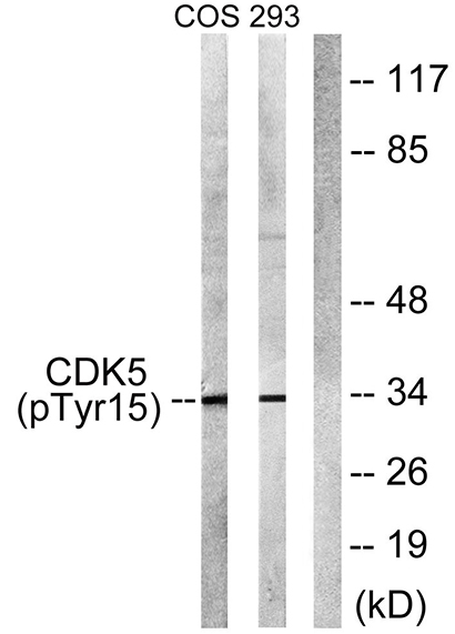 Cdk5 (phospho Tyr15) Rabbit Polyclonal Antibody | 兔多抗 | EnkiLife恩玑生命