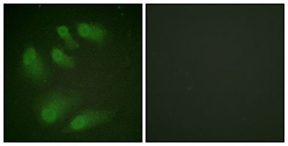 Chk1 (phospho Ser286) Rabbit Polyclonal Antibody | 兔多抗 | EnkiLife恩玑生命