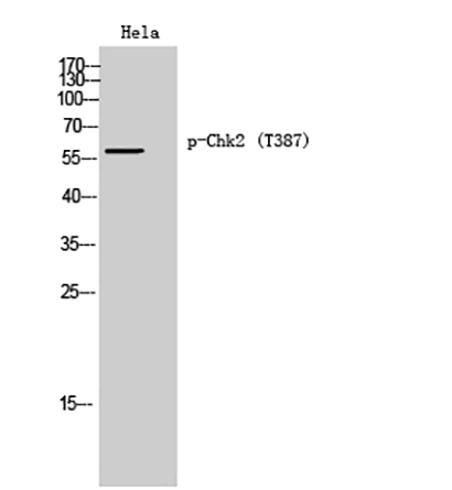 Chk2 (phospho Thr387) Rabbit Polyclonal Antibody | 兔多抗 | EnkiLife恩玑生命