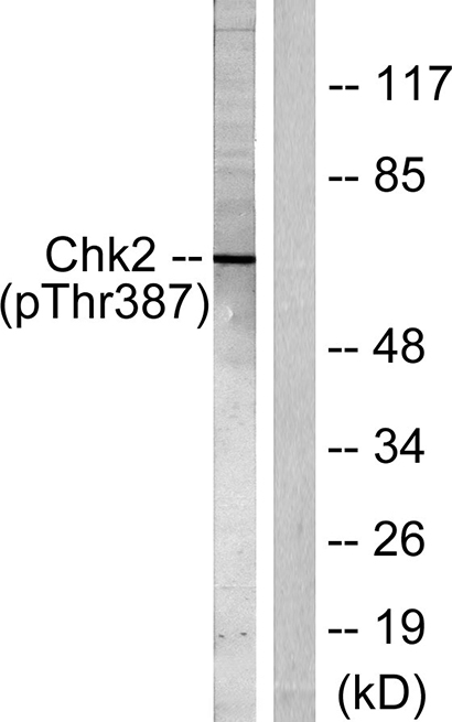 Chk2 (phospho Thr387) Rabbit Polyclonal Antibody | 兔多抗 | EnkiLife恩玑生命