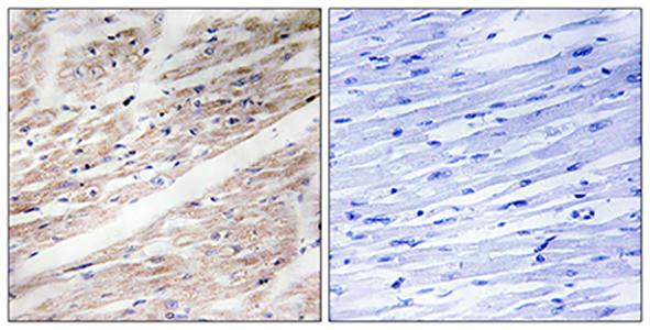 c-Kit (phospho Tyr936) Rabbit Polyclonal Antibody | 兔多抗 | EnkiLife恩玑生命