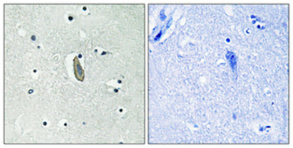 c-Kit (phospho Tyr936) Rabbit Polyclonal Antibody | 兔多抗 | EnkiLife恩玑生命