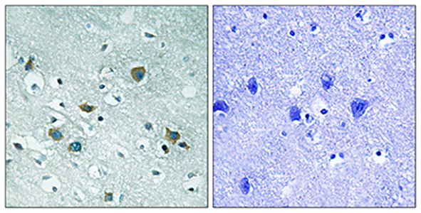 CRMP-2 (phospho Thr509) Rabbit Polyclonal Antibody | 兔多抗 | EnkiLife恩玑生命