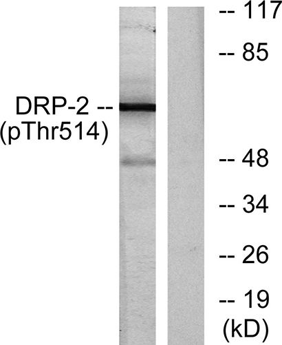 CRMP-2 (phospho Thr514) Rabbit Polyclonal Antibody | 兔多抗 | EnkiLife恩玑生命