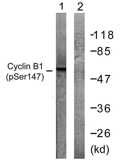 Cyclin B1 (phospho Ser147) Rabbit Polyclonal Antibody | 兔多抗 | EnkiLife恩玑生命