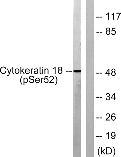 Cytokeratin 18 (phospho Ser52) Rabbit Polyclonal Antibody | 兔多抗 | EnkiLife恩玑生命