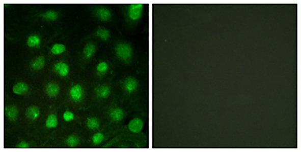 DNA-PKCS (phospho Thr2647) Rabbit Polyclonal Antibody | 兔多抗 | EnkiLife恩玑生命