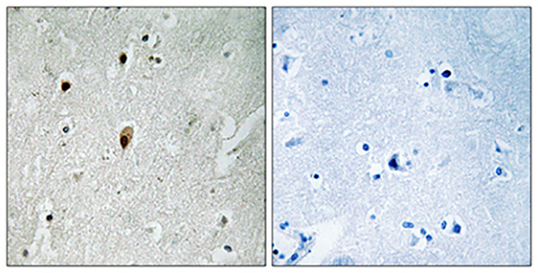 DNA-PKCS (phospho Thr2647) Rabbit Polyclonal Antibody | 兔多抗 | EnkiLife恩玑生命
