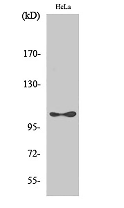 eEF2K (phospho Ser366) Rabbit Polyclonal Antibody | 兔多抗 | EnkiLife恩玑生命
