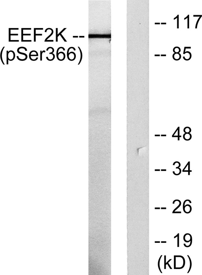 eEF2K (phospho Ser366) Rabbit Polyclonal Antibody | 兔多抗 | EnkiLife恩玑生命