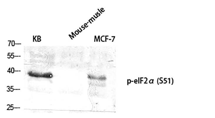 eIF2α (phospho Ser51) Rabbit Polyclonal Antibody | 兔多抗 | EnkiLife恩玑生命