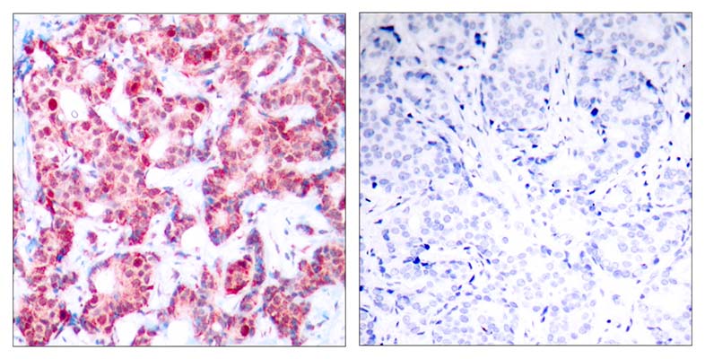 GATA-1 (phospho Ser142) Rabbit Polyclonal Antibody | 兔多抗 | EnkiLife恩玑生命