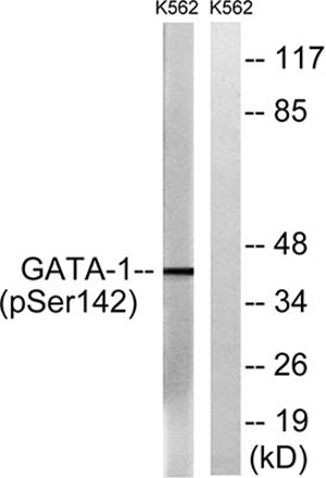 GATA-1 (phospho Ser142) Rabbit Polyclonal Antibody | 兔多抗 | EnkiLife恩玑生命