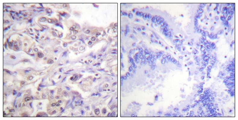 hnRNP D0 (phospho Ser83) Rabbit Polyclonal Antibody | 兔多抗 | EnkiLife恩玑生命