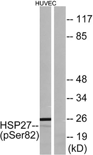 HSP27 (phospho Ser82) Rabbit Polyclonal Antibody | 兔多抗 | EnkiLife恩玑生命
