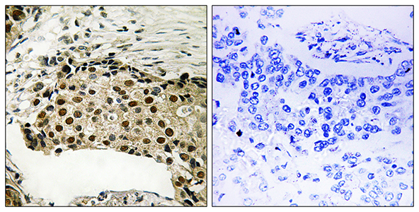 MSK1 (phospho Ser212) Rabbit Polyclonal Antibody | 兔多抗 | EnkiLife恩玑生命