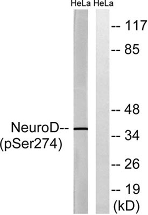 Neuro D (phospho Ser274) Rabbit Polyclonal Antibody | 兔多抗 | EnkiLife恩玑生命