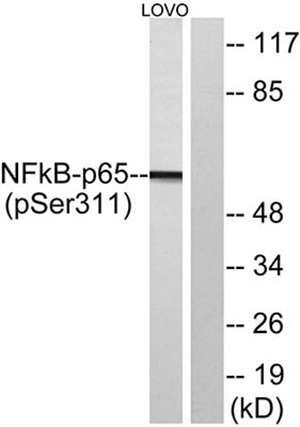 NFκB-p65 (phospho Ser311) Rabbit Polyclonal Antibody | 兔多抗 | EnkiLife恩玑生命
