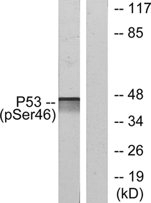 p53 (phospho Ser46) Rabbit Polyclonal Antibody | 兔多抗 | EnkiLife恩玑生命
