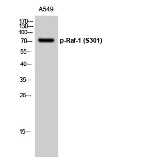 Raf-1 (phospho Ser301) Rabbit Polyclonal Antibody | 兔多抗 | EnkiLife恩玑生命