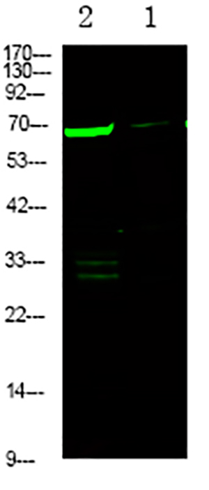 L-plastin (Phospho-Ser5) Rabbit Polyclonal Antibody | 兔多抗 | EnkiLife恩玑生命