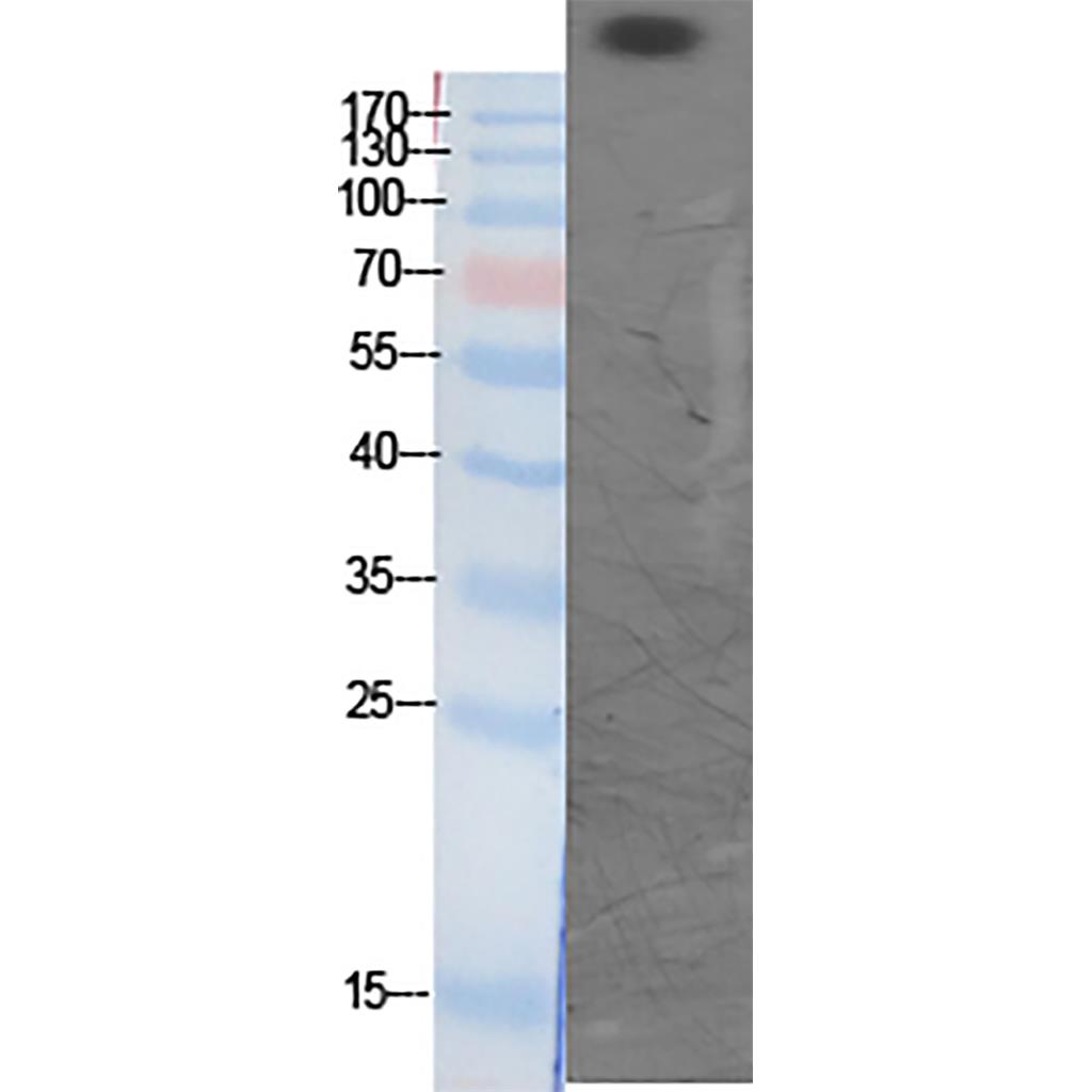 CBP (Acetyl Lys1535) Rabbit Polyclonal Antibody | 兔多抗 | EnkiLife恩玑生命