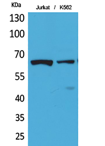 NFκB-p65 (Acetyl Lys218) Rabbit Polyclonal Antibody | 兔多抗 | EnkiLife恩玑生命