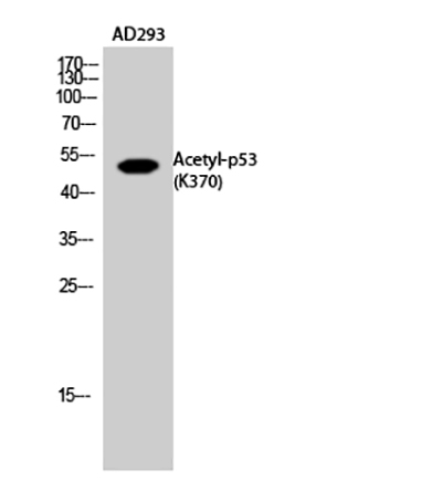 p53 (Acetyl Lys370) Rabbit Polyclonal Antibody | 兔多抗 | EnkiLife恩玑生命