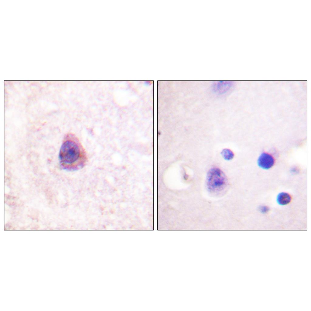 Arrestin-β-1 Rabbit Polyclonal Antibody | 兔多抗 | EnkiLife恩玑生命