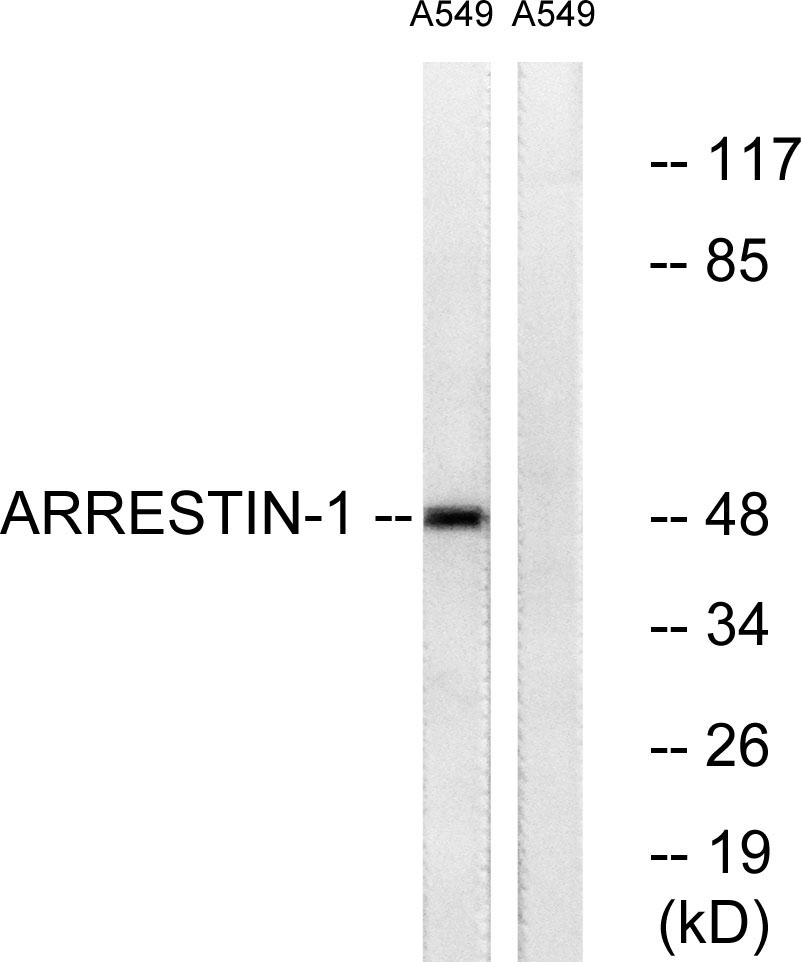 Arrestin-β-1 Rabbit Polyclonal Antibody | 兔多抗 | EnkiLife恩玑生命