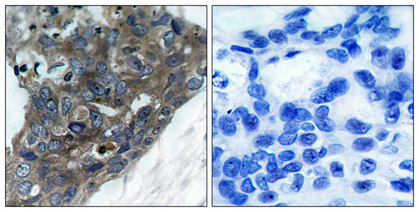 ASK 1 Rabbit Polyclonal Antibody | 兔多抗 | EnkiLife恩玑生命