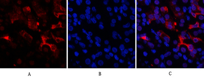 Bcl-6 Rabbit Polyclonal Antibody | 兔多抗 | EnkiLife恩玑生命
